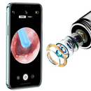 Smart Visual Ear Cleaner with 1080P HD Camera | Wireless Ear Wax Removal Otoscope | LED Ear Cleaning Tool for Android & iOS | Rechargeable & Portable